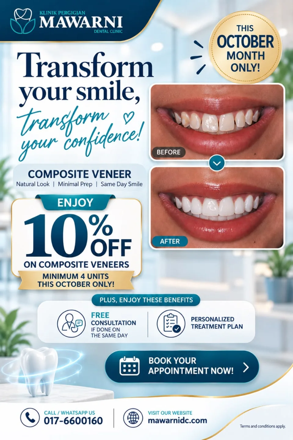 Mawarni Dental Clinic promotion: 10% off composite veneers, minimum 4 units, this October only. Free same-day consultation and personalised treatment plan.