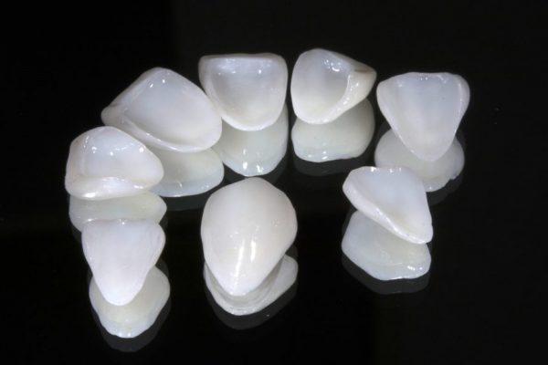 Ceramic Veneers (2)