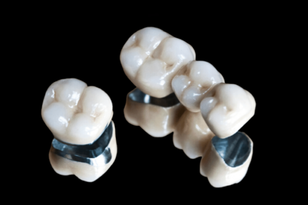 Dental-crown-vs.-dental-bridge-1024x536